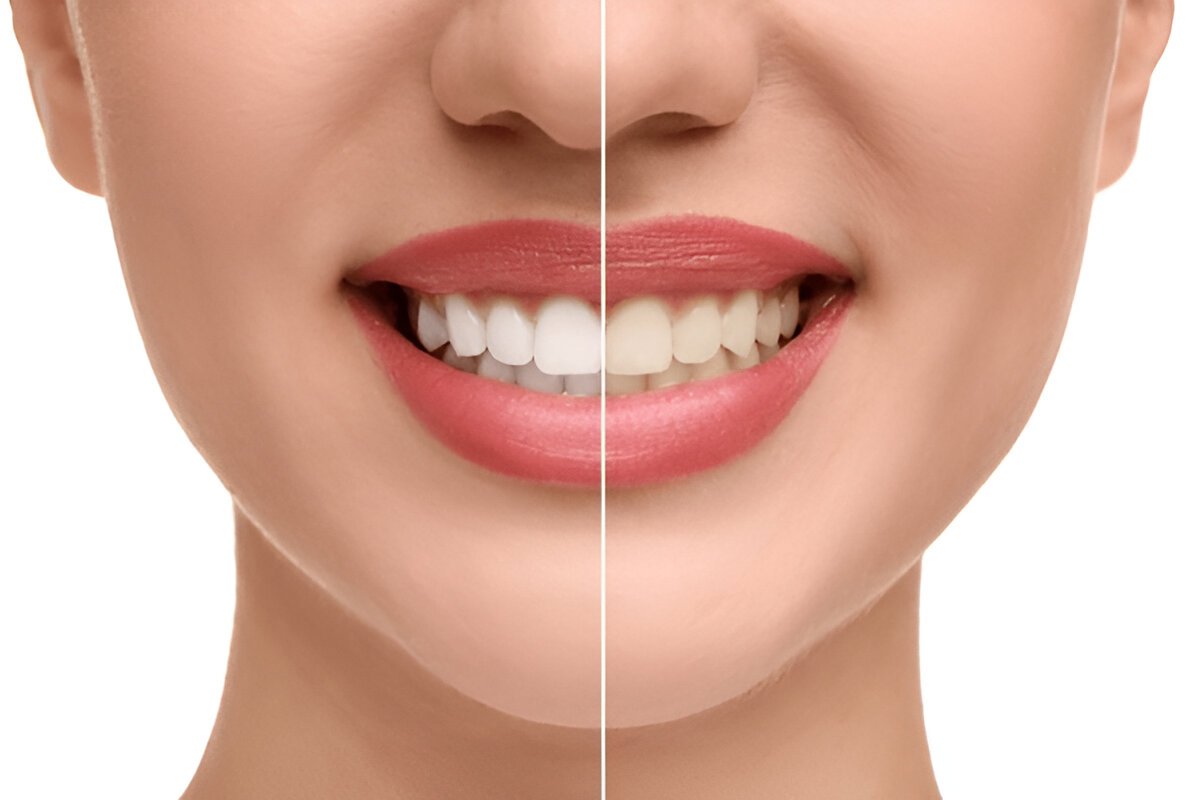 Top 10 Common Dental Myths Debunked | Expert Dental Tips