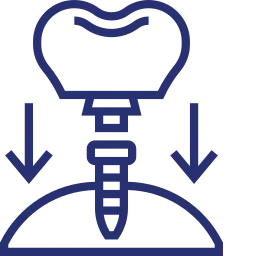 Highlighted Icon for Dental Implant Services