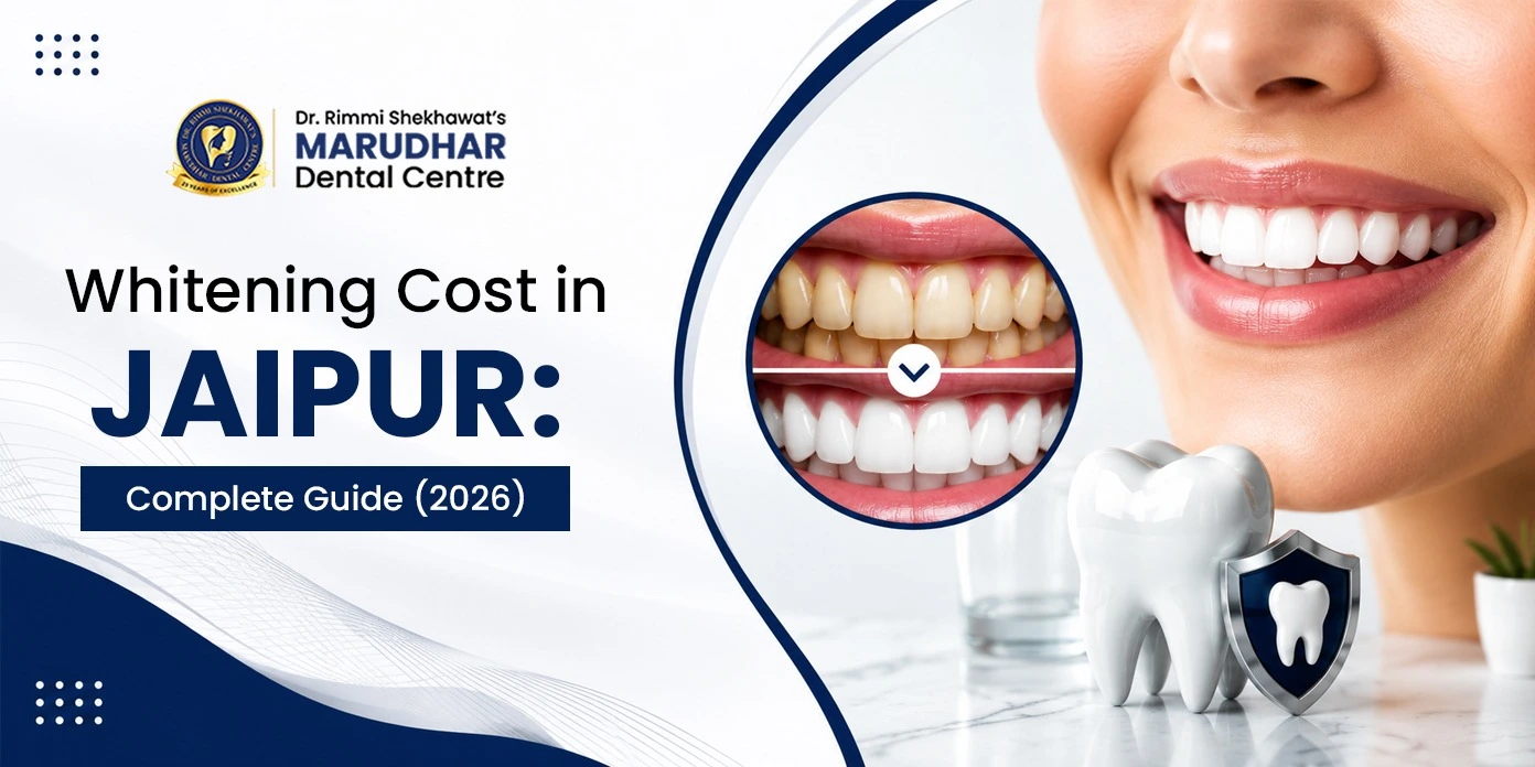Professional teeth whitening treatment in Jaipur  
