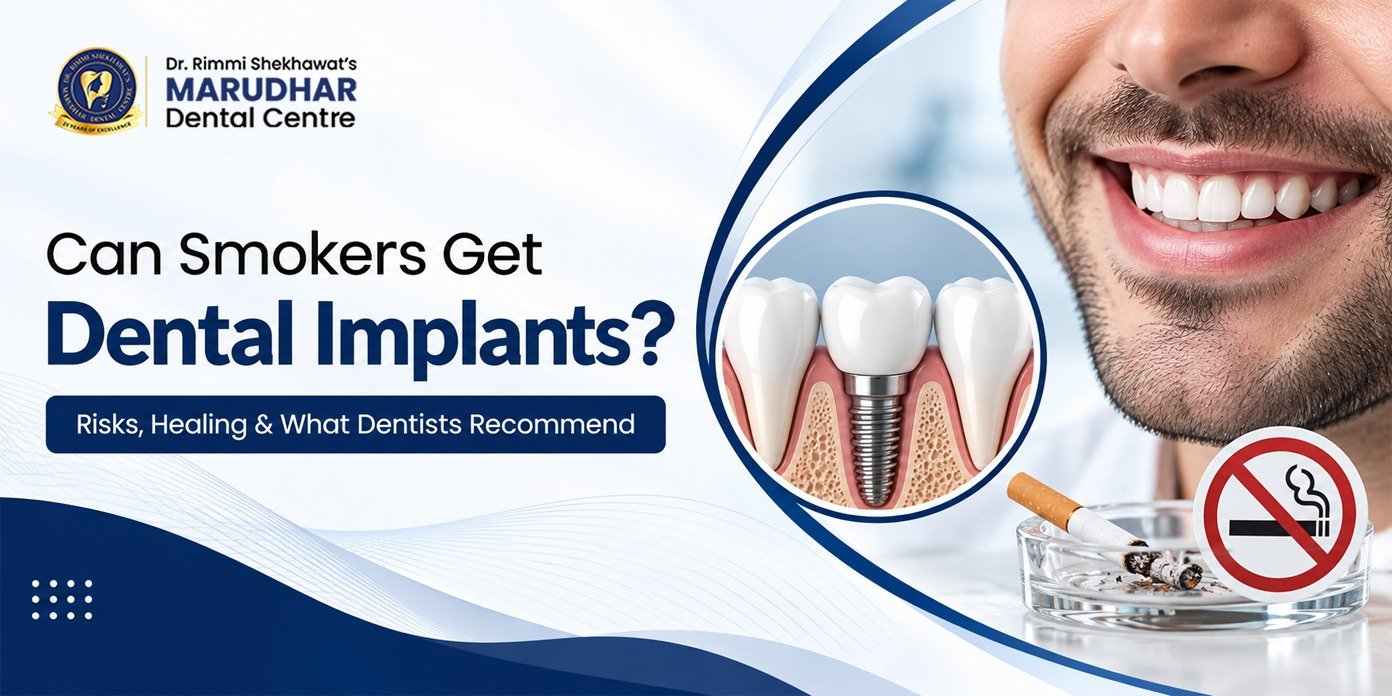 Can Smokers Get Dental Implants