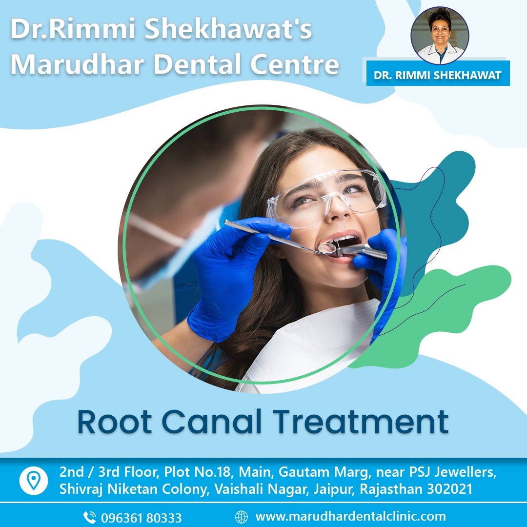 root canal treatment in jaipur
