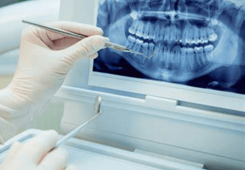 Aesthetic Dentistry courses